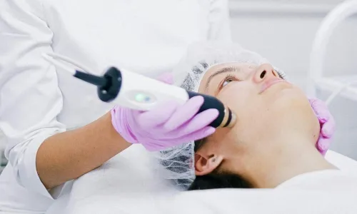 Microdermabrasion Chevy Chase