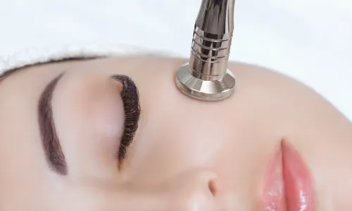 Microdermabrasion
