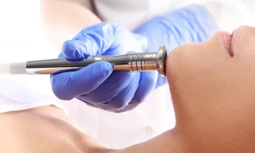 Microdermabrasion md