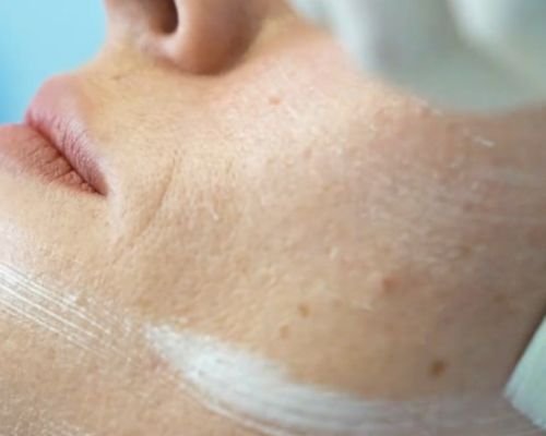 Clinical Grade Skin Correction Bethesda, MD