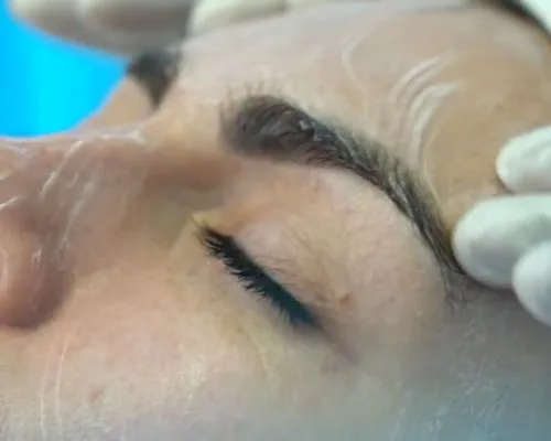 local skin care treatment