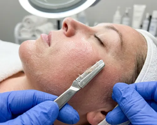Dermaplaning Facial Service Chevy Chase MD