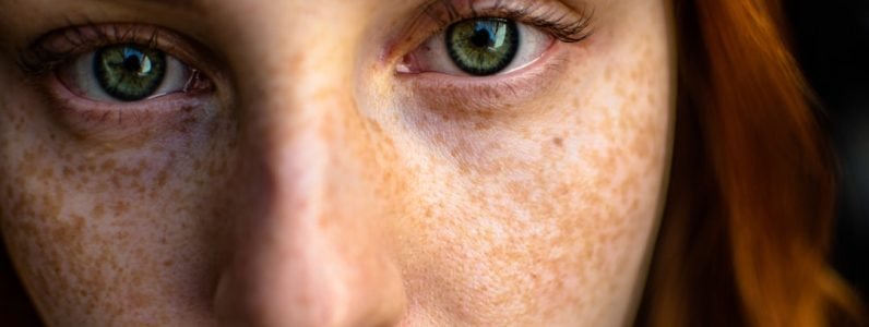 fraxel-laser-vs-rf-microneedling--expert-insights-from-rejuvenate-spa-in-chevy-chase