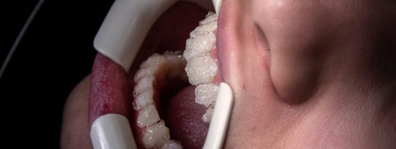 Mouth-Body Connection: How Oral Health Boosts Your Holistic Wellness ...